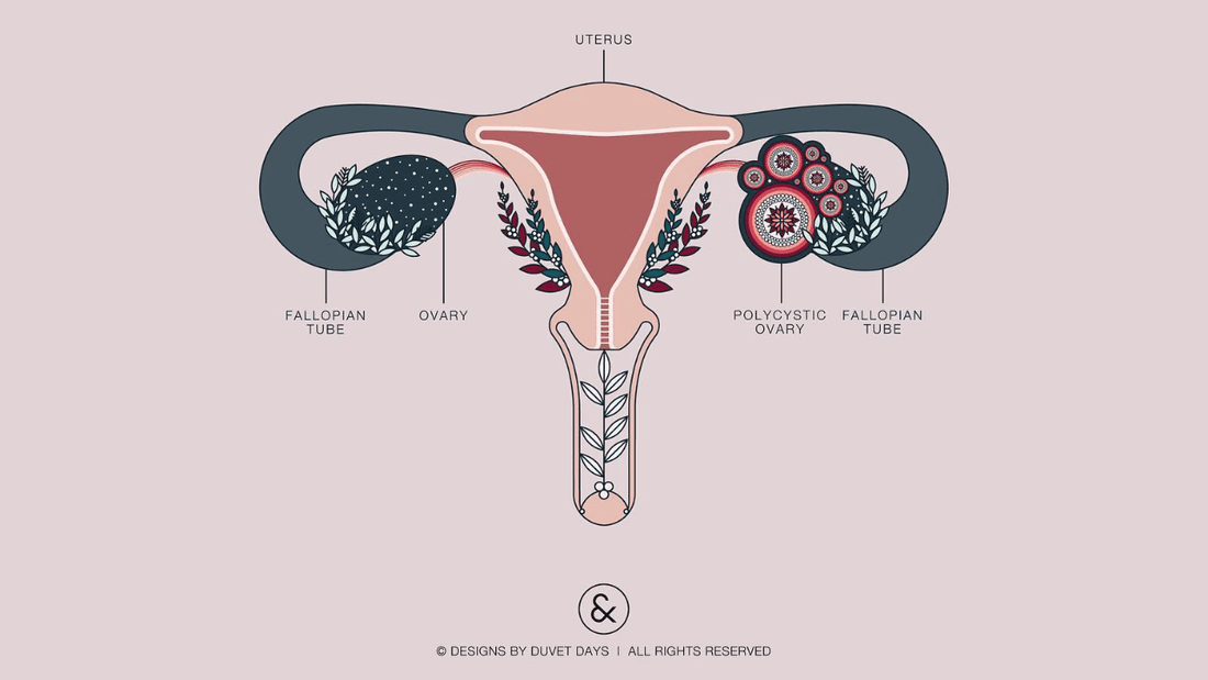 Food & PCOS